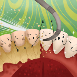 detartrasi - ablazione tartaro - pulizia dentale