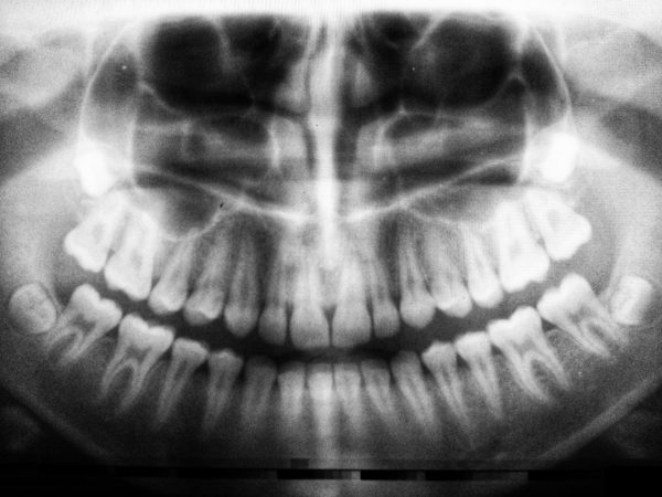 Prima Visita + Radiografia - immagine 2