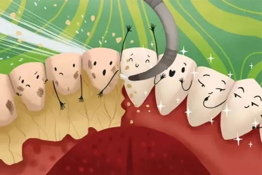 Ablazione Tartaro - Detartrasi - Igiene Dentale - Pulizia dei Denti Roma