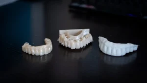 Denti in Zirconio - Denti di Zirconio