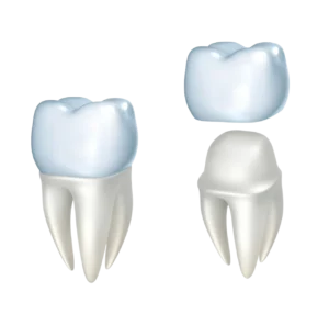Corona Dentale