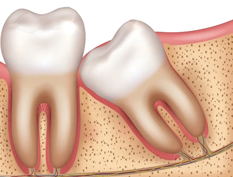 Denti del giudizio inclusi